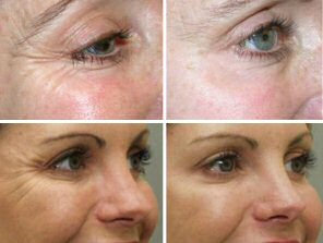 Retinol+VitaminaC